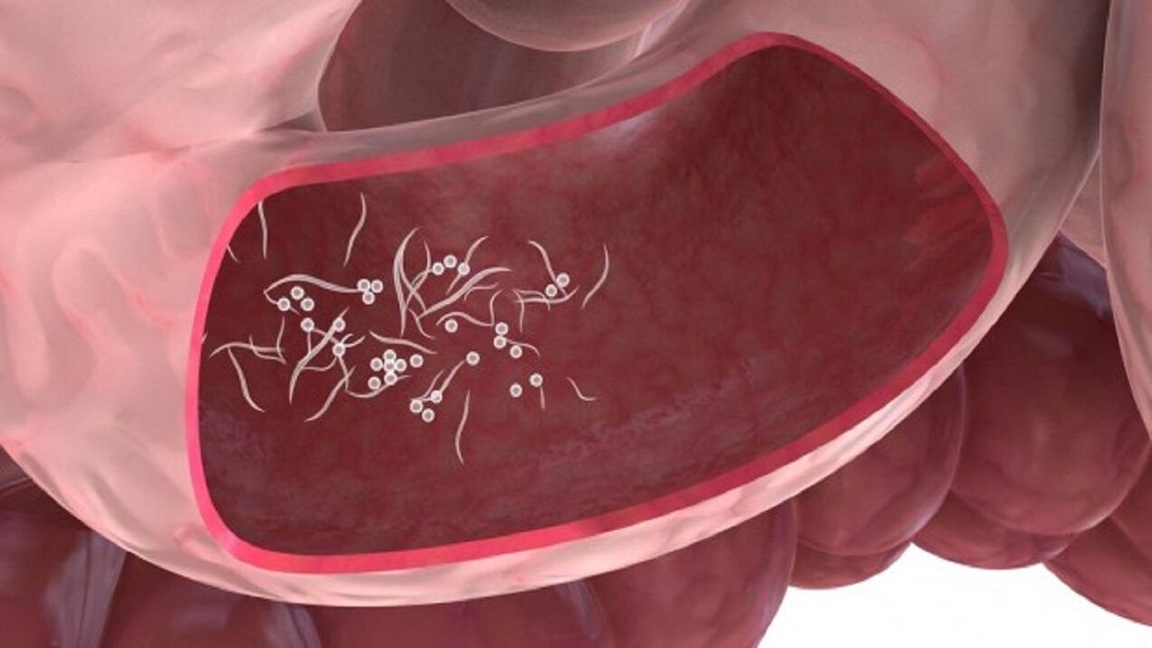 Παράσιτα Giardia στο ήπαρ