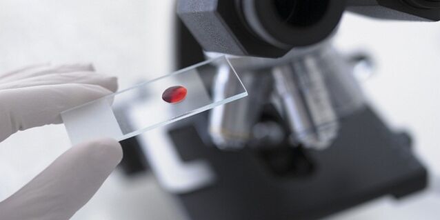 εξέταση αίματος για τη διάγνωση παρασίτων στο σώμα